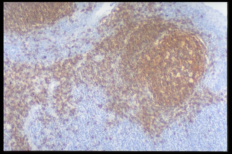 img0034.jpg (103757 bytes)